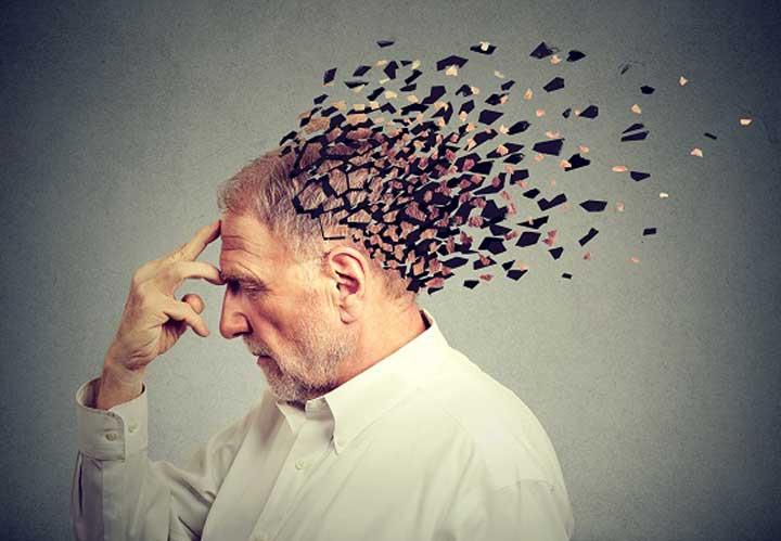 بیماری آلزایمر