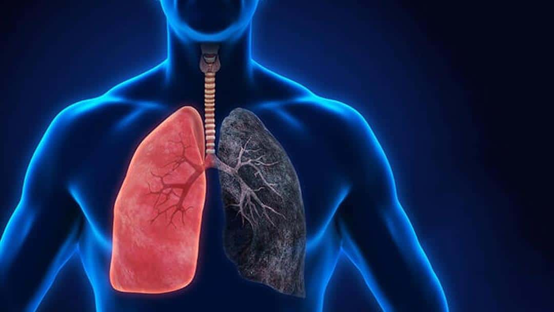 بیماری‌ انسدادی مزمن ریه (COPD)
