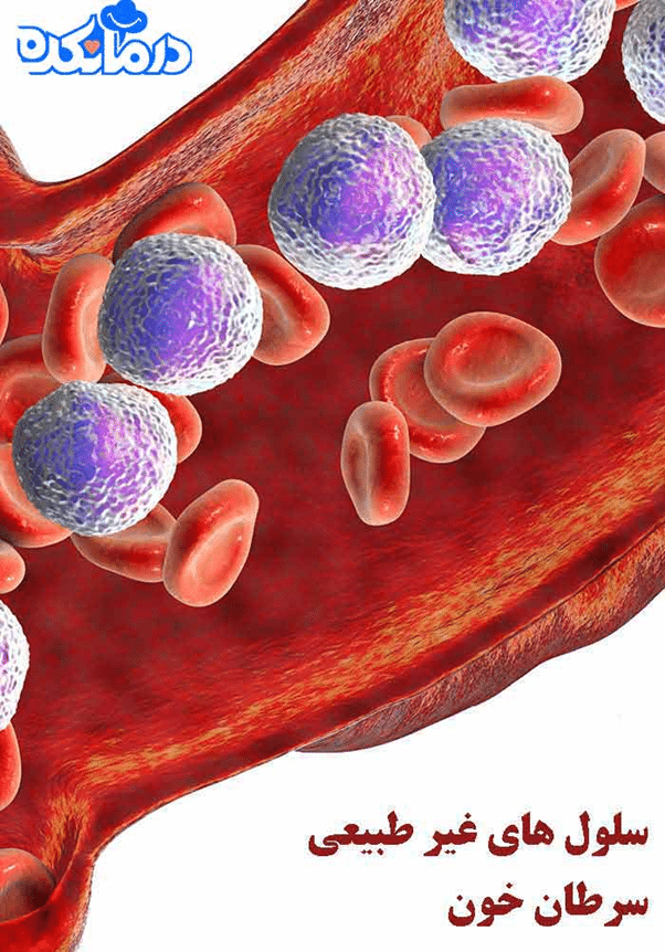سلول های غیر طبیعی سرطان خون
