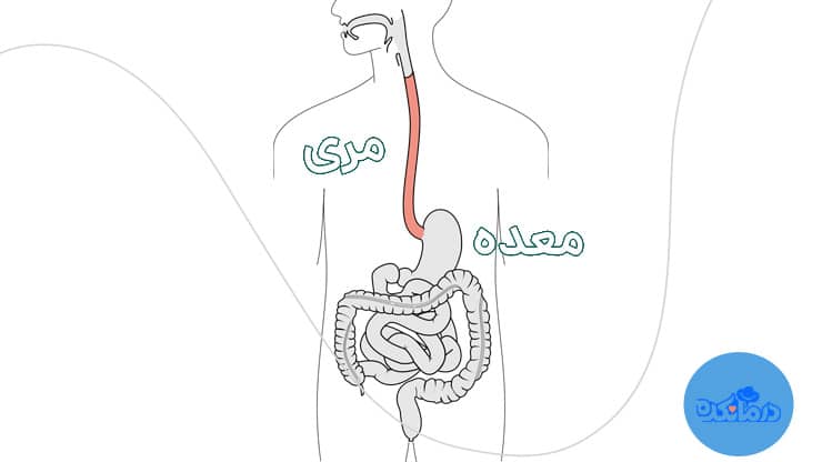 مری