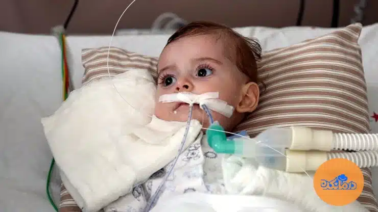 بیماری SMA چیست؟ علت، علائم، انواع + بهترین روش‌های درمان