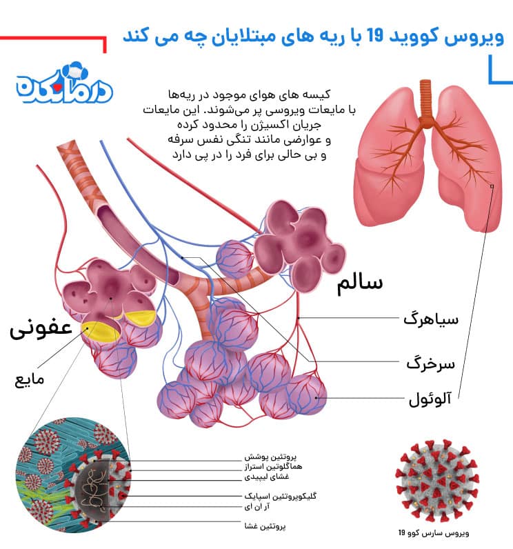 تاثیر ویروس کرونا بر ریه