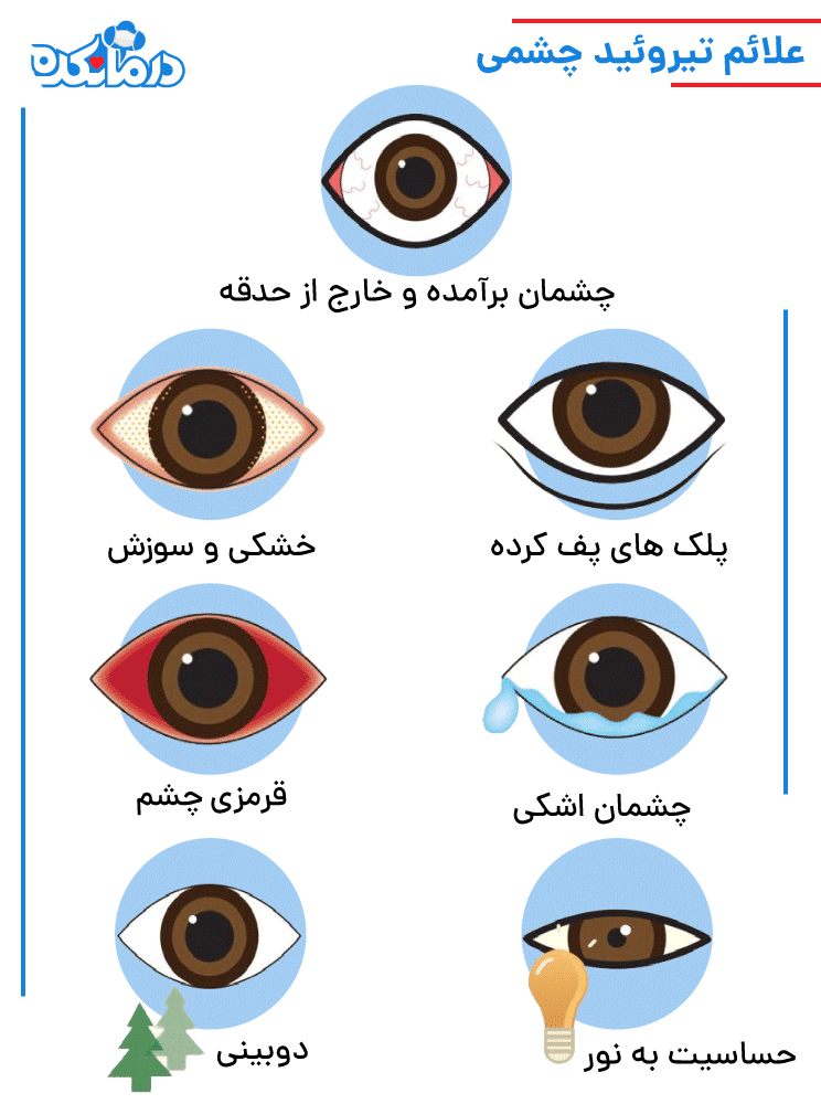 علائم تیروئید چشمی