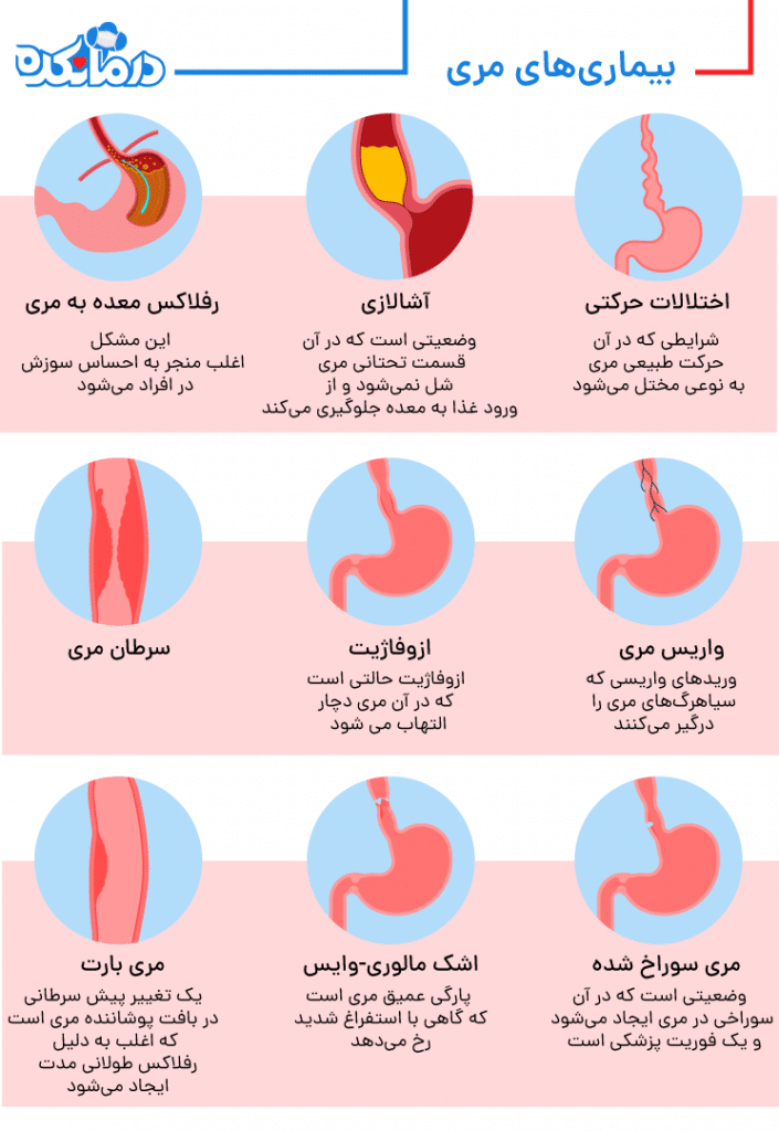 بیماری های مری