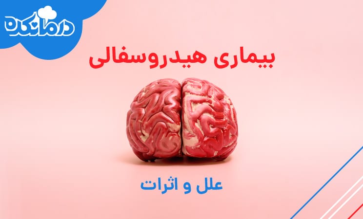 هیدروسفالی