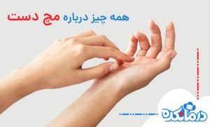 همه چیز درباره مچ دست