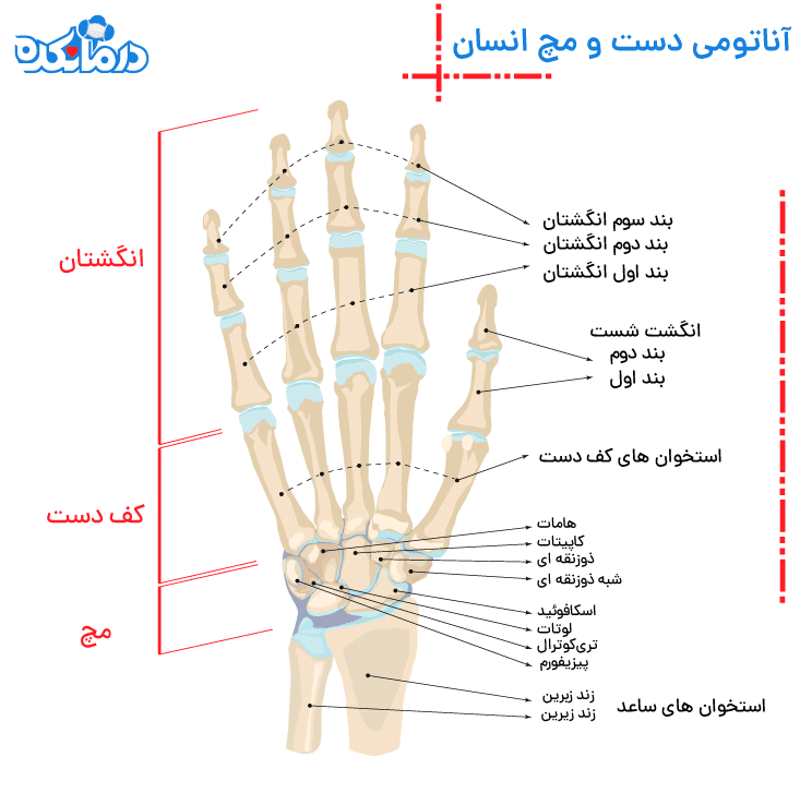 شکلی از مچ دست