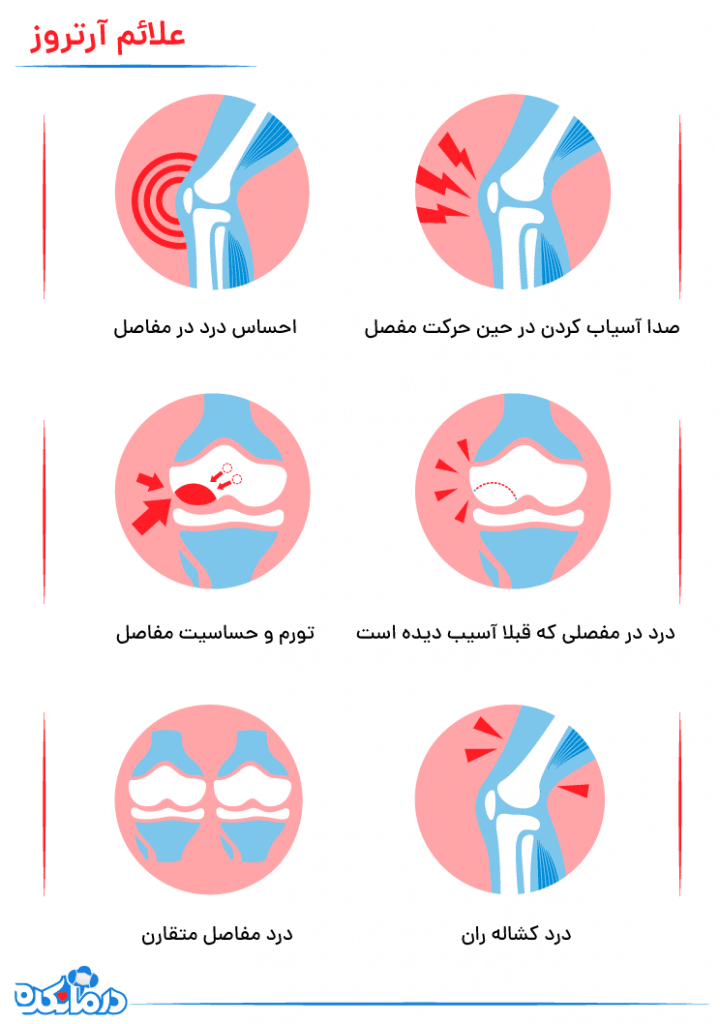 تصویری از اینفوگرافیک علائم ابتلا به آرتروز