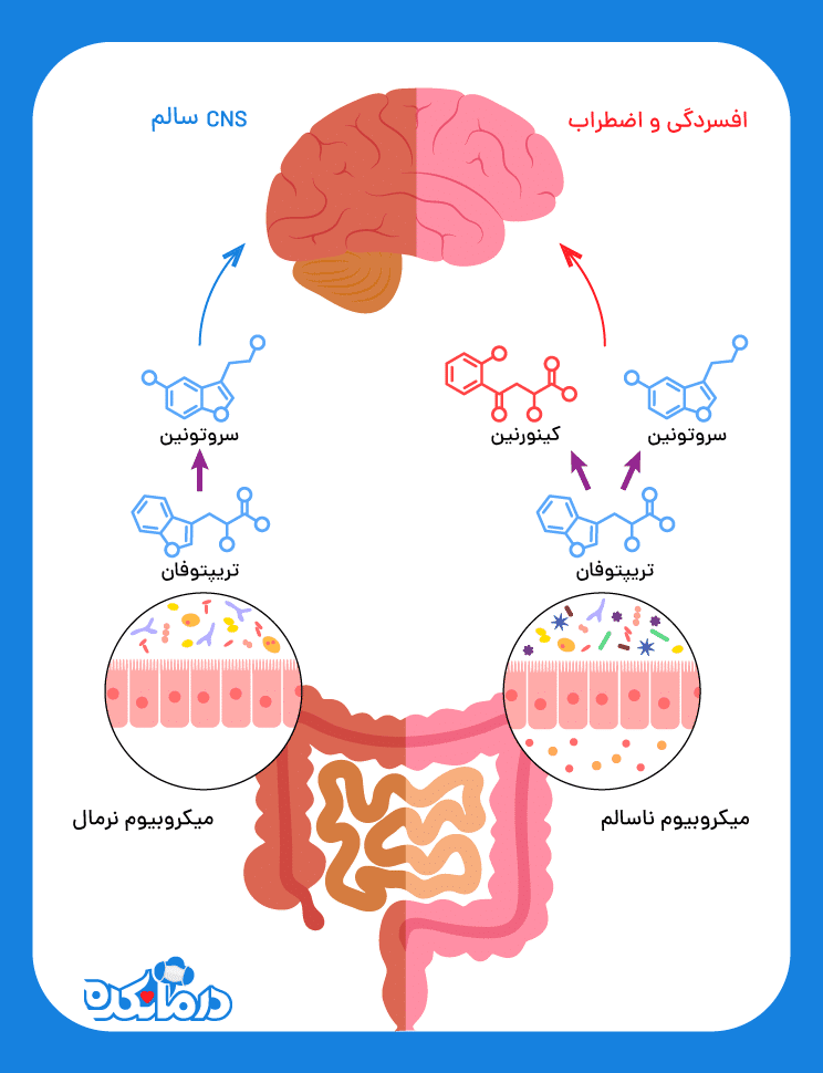 میکروبیوم ناسالم و افسردگی