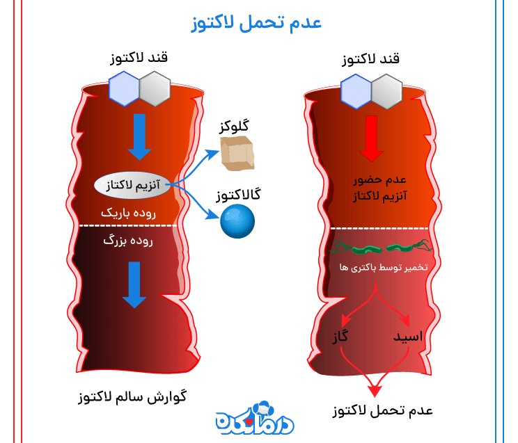 تصویر گوارش سالم در برابر عدم تحمل لاکتوز