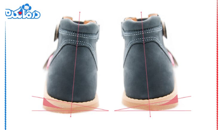 یک جفت کفش طبی را می‌بینید که در آن زاویه‌های طراحی کفش نشان داده شده است.