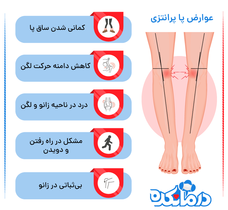 عوارض پا پرانتزی