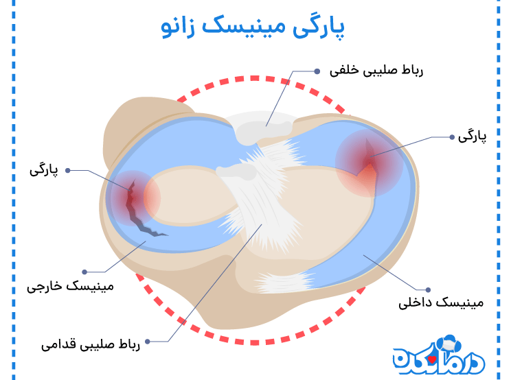 آناتومی مینیسک زانو