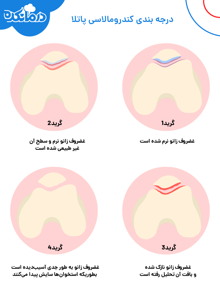 درجه بندی کندرومالاسی پاتلا