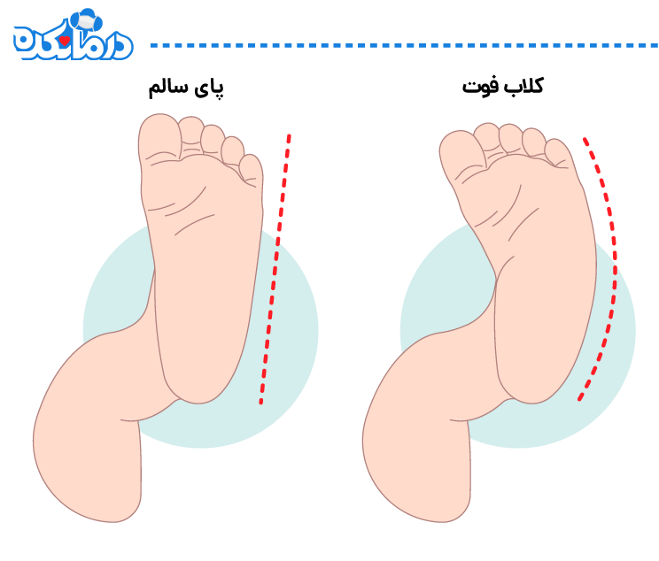 پاچنبری