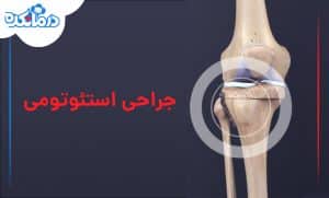 عمل استئوتومی