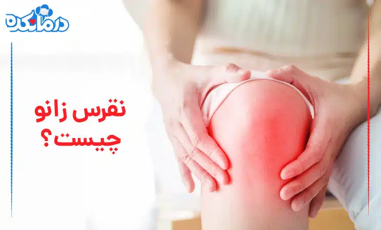 نقرس زانو چیست؟ + راه‌های درمان و پیشگیری :