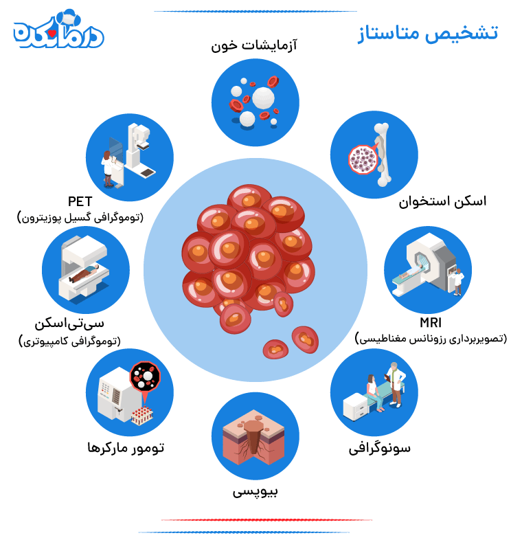 اینفوگرافیکی از انواع راه های تشخیص ابتلا به متاستاز