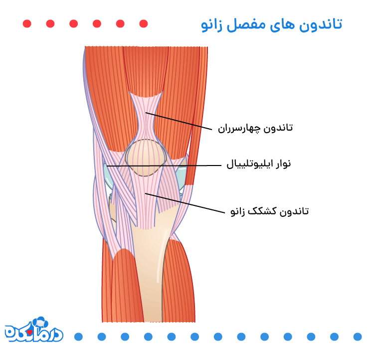 التهاب تاندون زانو