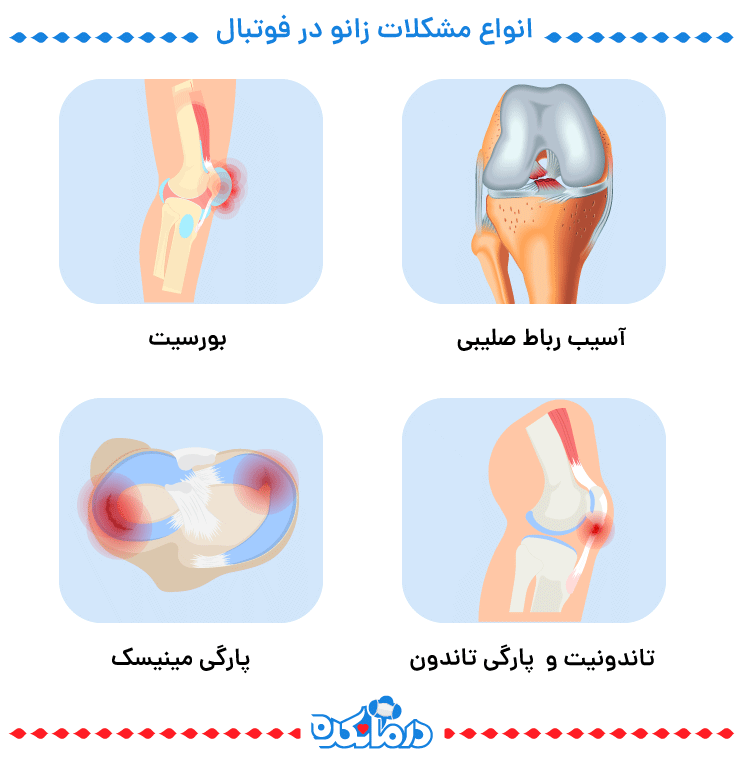 اینفوگرافیکی از انواع آسیب های زانو فوتبالیست