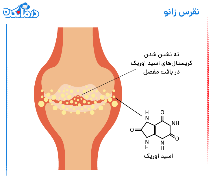 تصویر گرافیکی مفصل زانو