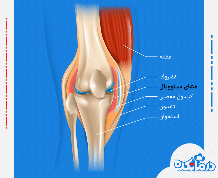 رایج‌ترین دلیل صدا دادن زانو