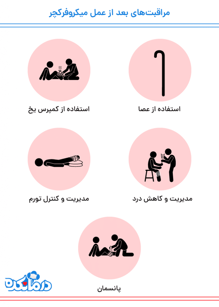 مراقبت های بعد از عمل میکروفراکچر زانو