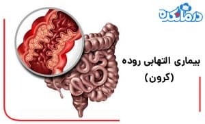 بیماری التهابی روده (کرون)