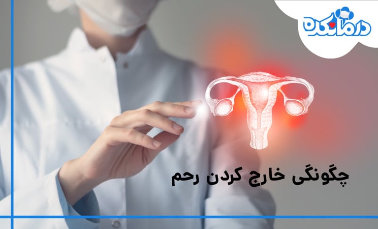 چگونگی خارج کردن رحم