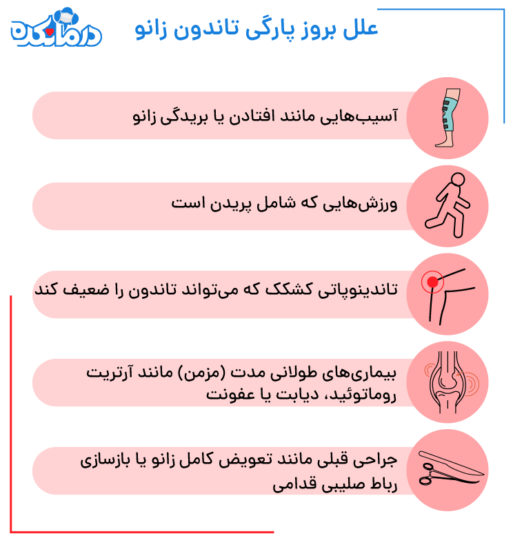 اینفوگرافیکی از علل بروز پارگی تاندون زانو