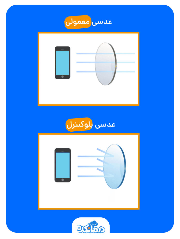 مقایسه عدسی ساده و بلوکنترل در برابر صفحه نمایش موبایل. عدسی بلو کنترل نور آبی را فیلتر می‌کند اما عدسی ساده نور آبی را از خود عبور می‌دهد.