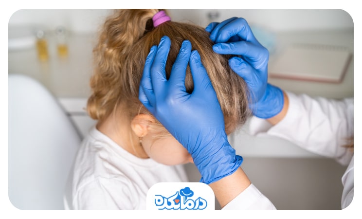 پزشک با بررسی موها و پوست کف سر  کودک شپش را شناسایی می‌کند.