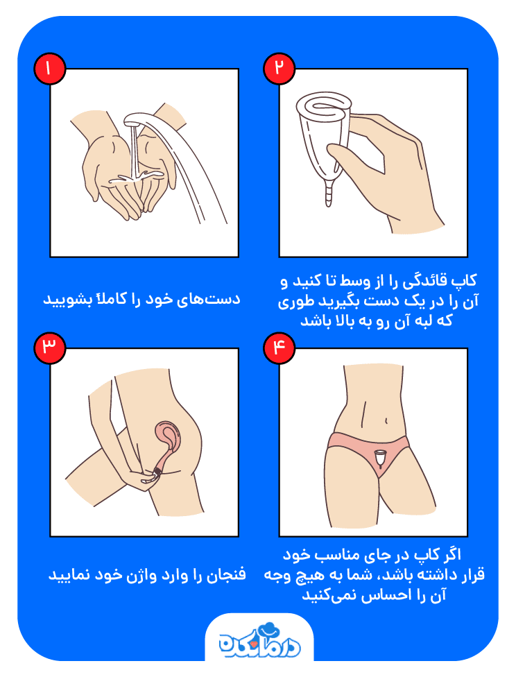 نحوه جای گذاری