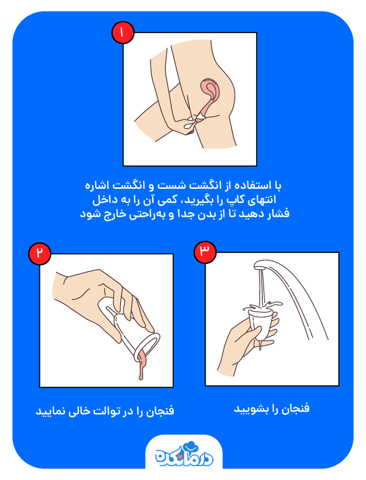 نحوه خارج کردن کاپ قائدگی