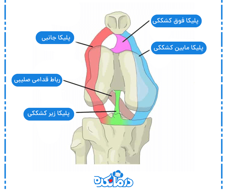 جایگاه سندروم پلیکا در زانوی پای انسان