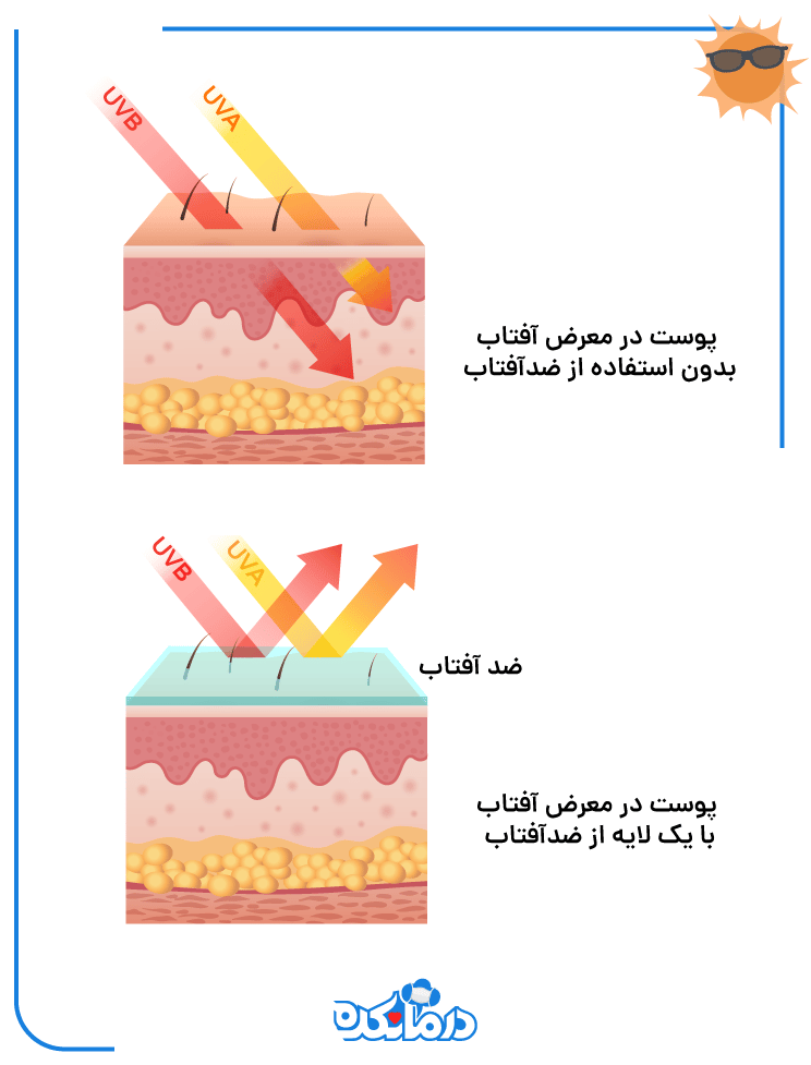 کرم‌های ضدآفتاب تا حد زیادی از پوست در برابر اشعه‌های مضر محافظت می‌کنند