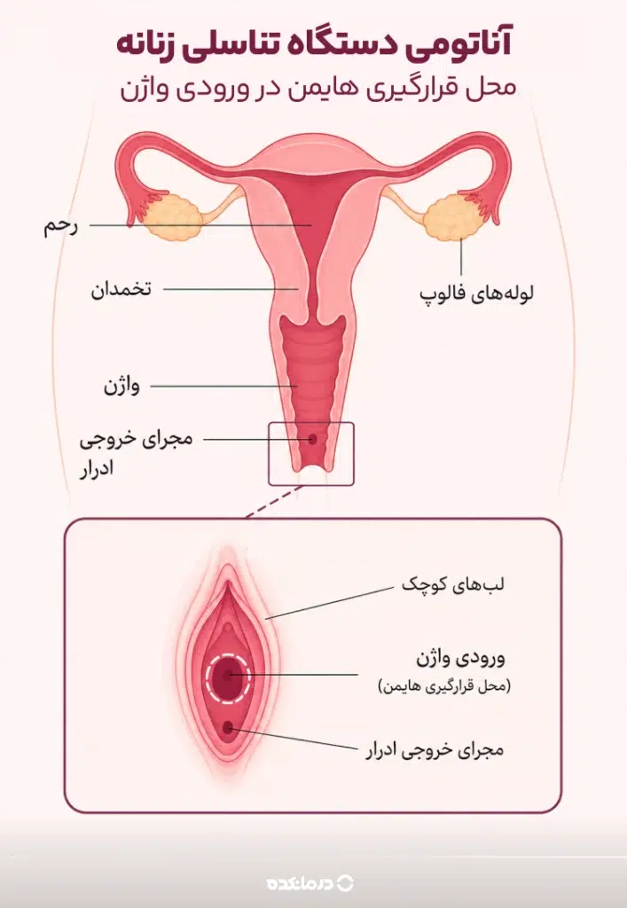 محل قرارگیری پرده بکارت یا هایمن در ورودی واژن