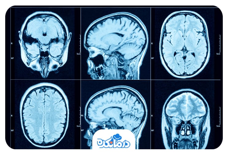 تصاویری از جمجمه یک فرد که اسکن مغزی انجام داده است