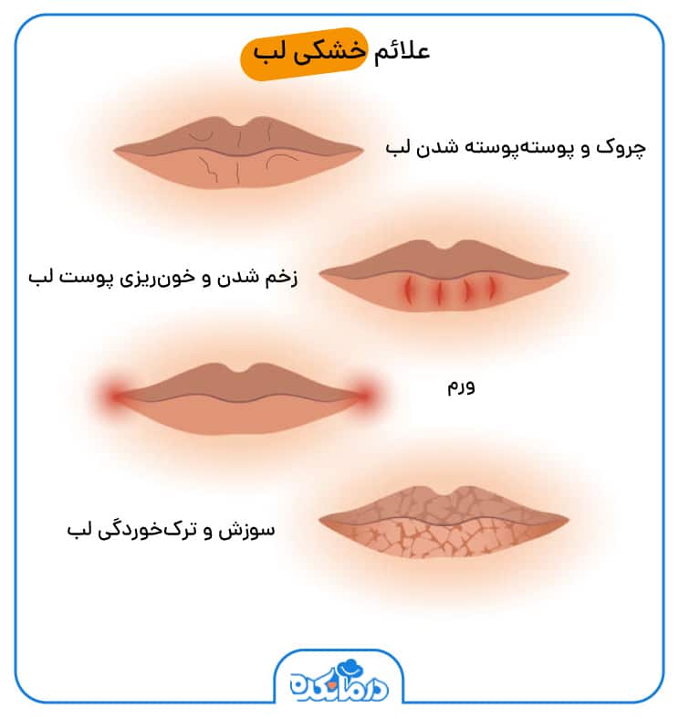 اینفوگرافی علائم خشکی لب