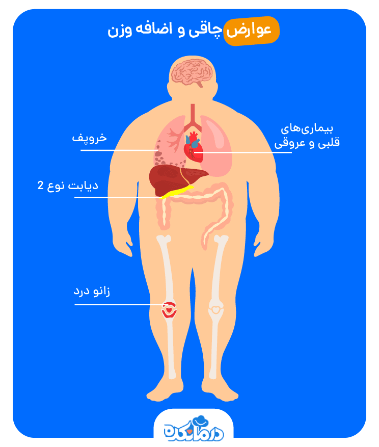 اینفوگرافیکی که در آن عوارض جسمی چاقی مانند خروپف، دیابت نوع ۲، بیماری قلبی و زانو درد نشان داده شده است.