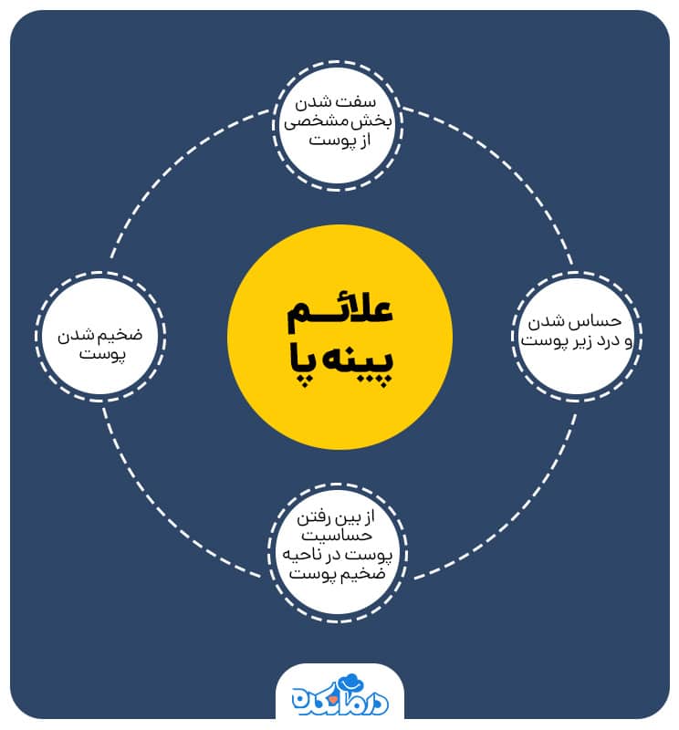 تصویری از علائم پینه پا