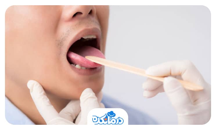 بیماری که دهان خود را باز کرده است و پزشک در حال معاینه زبان او است