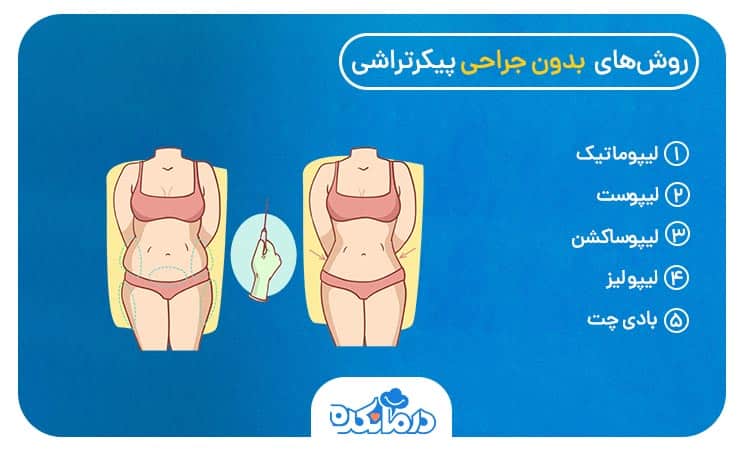 اینفوگرافیکی از انواع روش های غیر جراحی پیکر‌تراشی