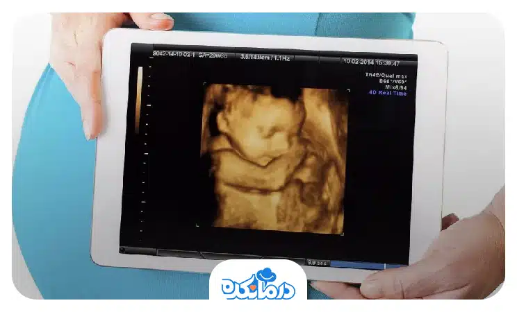  تصویری از سونوگرافی سه بعدی بارداری با هدف تشخیص ناهنجاری‌هایی مادرزادی مانند لب‌شکری