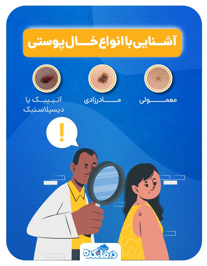 اینفوگرافی از انواع خال پوستی