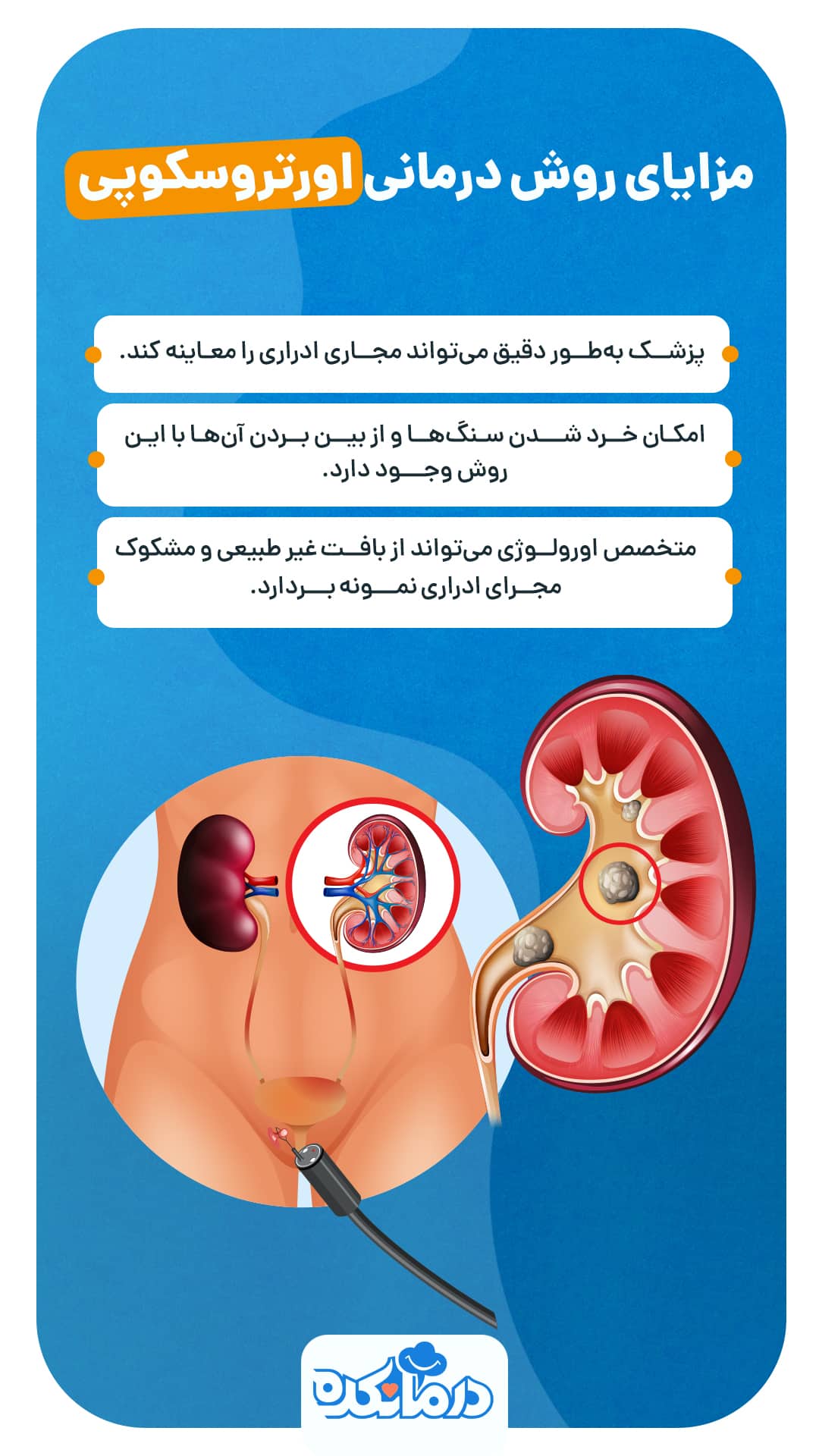 اینفوگرافی از مزایای روش درمانی اورتروسکوپی