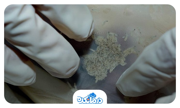 تصویری از لارو درمانی که در آن نوزاد حشرات روی زخم قرار گرفته است.