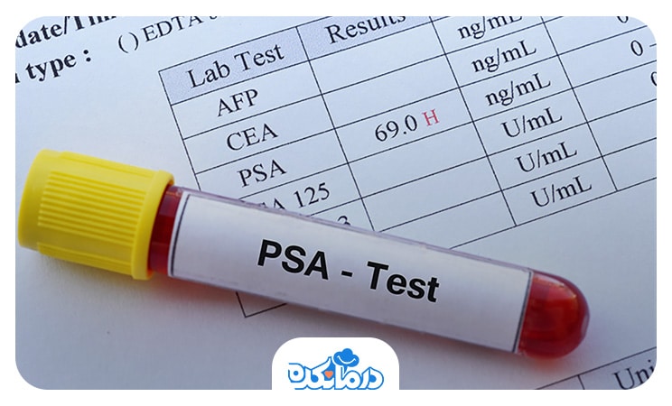 تصویر لوله آزمایشگاه حاوی خون و برچسب تست psa