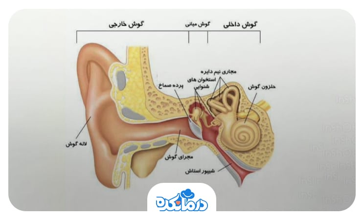 تصویر گرافیکی از گوش طبیعی همراه با مجرای گوش، پرده گوش، حلزون و عصب شنوایی
