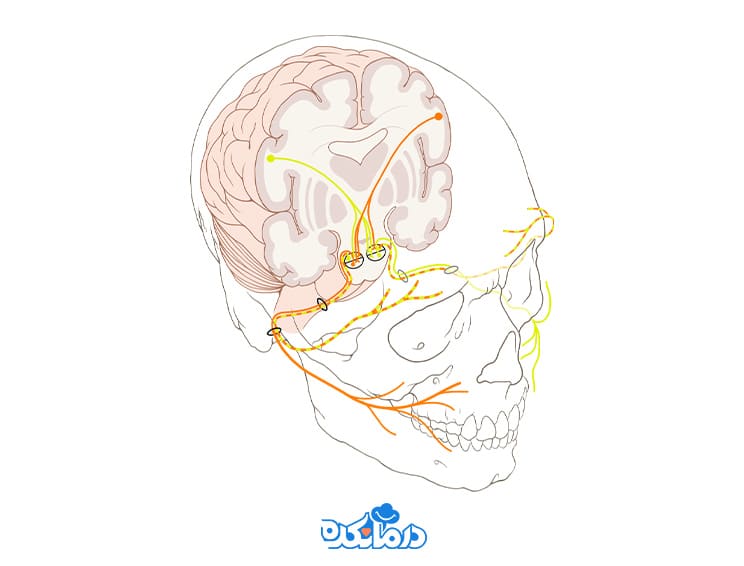 تصویر گرافیکی جمجمه همراه با عصب موثر در فلج بل